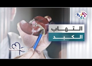 التهاب الكبد الأعراض والأسباب وطرق العلاج