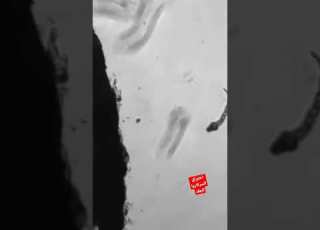 طريقة الإصابة بالبلهارسيا Schistosoma