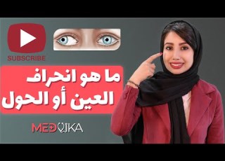 ما هو انحراف العين الاسباب و طرق العلاجها طب العيون في ايران مع مدفيكا