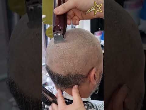 علاج طبيعي للقشره الشعر