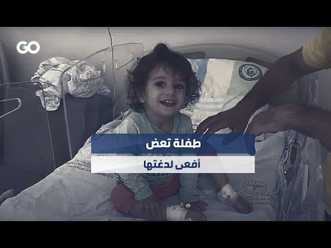 الميادين Go طفلة تعض أفعى لدغتها