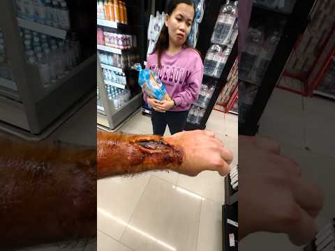 رسمت جرح عالايدي ومقلبت الناس