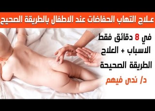  علاج التهاب الحفاضات عند الاطفال بالطريقة الصحيح في 8 دقائق فقط مع الدكتورة ندى فيهم