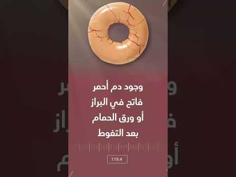 اعراض الشرخ الشرجي ما هو الشرخ الشرجي و ما هي أعراضه والفرق بين الشرخ الحاد والمزمن