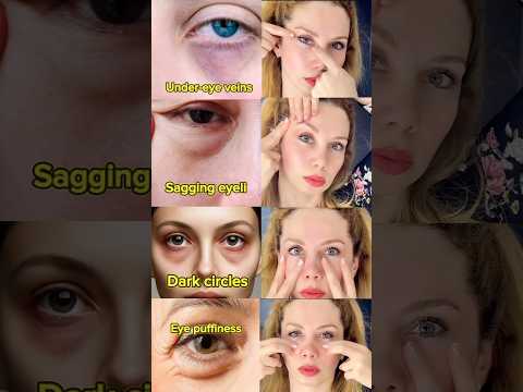 تمارين هتخلصك من مشكل تحت العين Facemassage Faceyoga Yoga Yogafacial مساج للوجه مساج علاجي