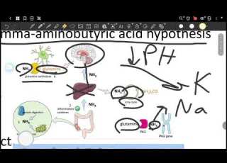 L35 Medicine Hepatic Encephalopathy Med IV 41
