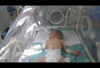 مشاكل الرئتين عند الأطفال حديثي الولادة