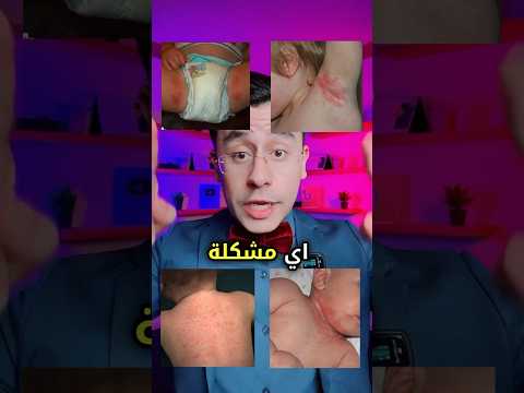 لو طفلك عنده اي مشكلة من دول الكريم ده هيحلهالك لو طفلك عنده اي مشكلة من دول الكريم ده هيحلهالك