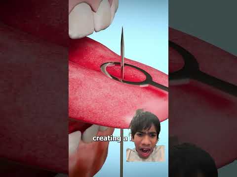 How Do They Pierce Your Tongue