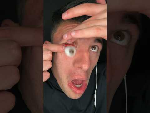 MY EYEBALL POPPED OUT