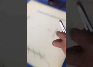 Vertical Mattress Suture Tutorial Medicalstudent Medico Surgerytips