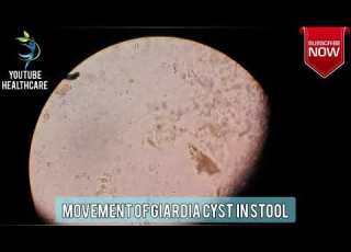  Giardia Cyst Under Microscope By YouTube Healthcare