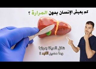 كم سنة يعيش الانسان بعد استئصال المرارة وما المشاكل التي يواجهها وما الحل دروس طبية