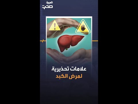 علامات تحذيرية لمرض الكبد علامات تحذيرية لمرض الكبد
