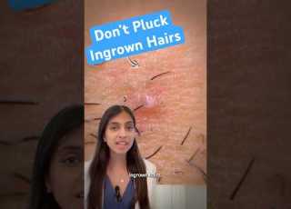 Don T Pluck Ingrown Hairs