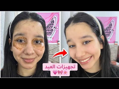 اقوي ماسك للهالات السوداء والانتفاخ تحت العين والتصبغات ب 3 مكونات فقط الهالات هتختفي في 3 ايام