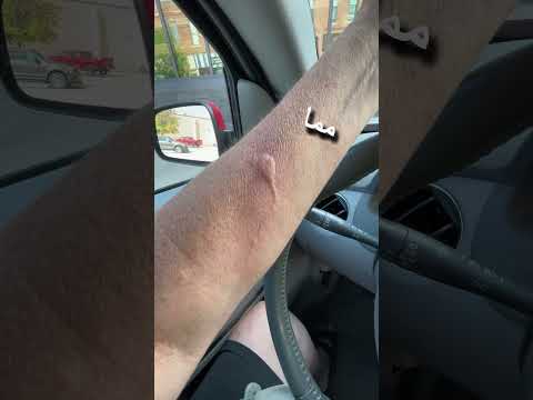 كيفية النجاة من هجوم النحل