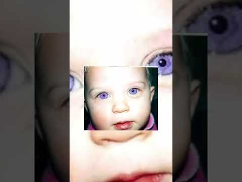 هل انت منهم حالة نادرة من العيون البنفسجية والبشرة البيضاء