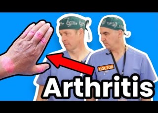  Best Way To Stop Arthritis Or At Least Slow It Down
