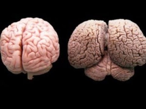 الرقية الشرعية علاج جميع امراض الدماغ الرقية الشرعية علاج جميع امراض الدماغ