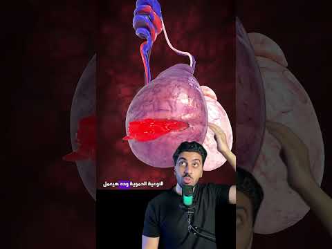 هو ممكن ركلة في الخصية تخلص عليك