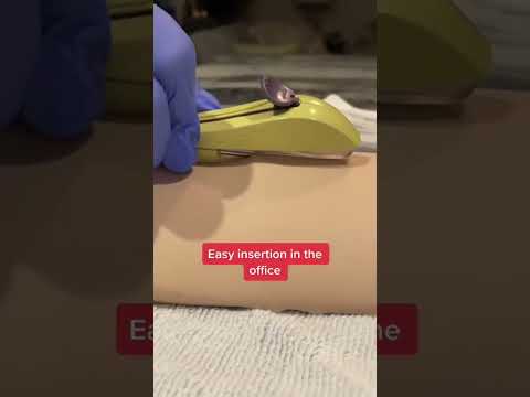 Nexplanon Birth Control Implant Insertion Nexplanon Birth Control Implant Insertion