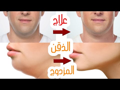 تخلص من مشكلة الذقن المزدوج نهائيا Double Chin