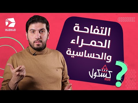 التفاحة الحمراء والحساسية كشكول تركي