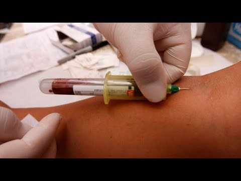 Saskatchewan S HIV Rate Highest In Canada Up 800 In 1 Region