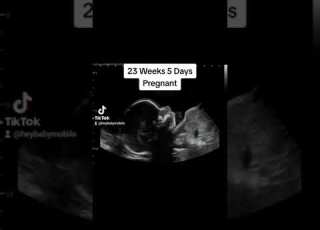  2D 3D 4D Ultrasound At 23 Weeks 5 Days Pregnant