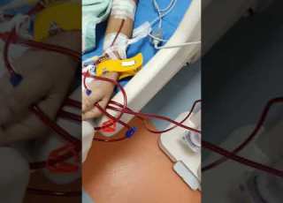  Dialysis Kidney Patient Viral Short Video