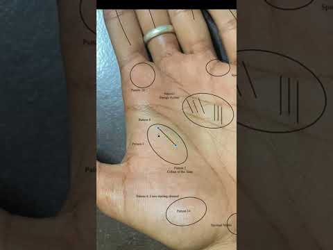 Multiple Lines Reach Out To Me On 8951568344 To Know More