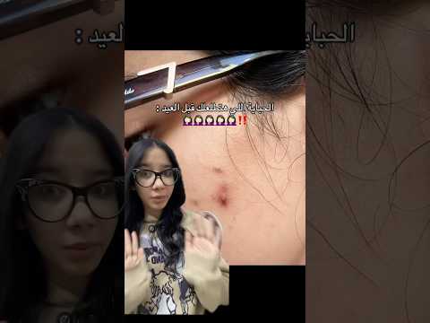 الحباية اللي هتطلعلك قبل العيد Trending العيد اكسبلور Skincare