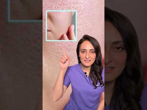 Open Pores How To Treat What To Do What To Avoid Open Pores How To Treat What To Do What To Avoid