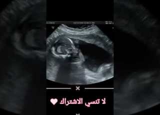 The Movements Of A Male Fetus And The Movements Of A Female Fetus The Difference Between Them A