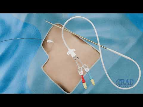 Tunneled Dialysis Catheter Placement Tunneled Dialysis Catheter Placement