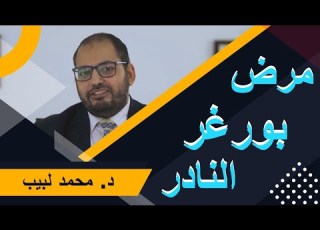 تعرف على مرض بورغر المرض النادر و تأثيره على الأوعية الدموية و علاقته بالمدخنين د محمد لبيب