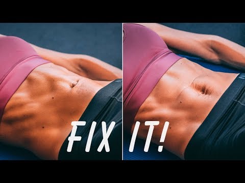 DIASTASIS RECTI What It Is How To Fix It