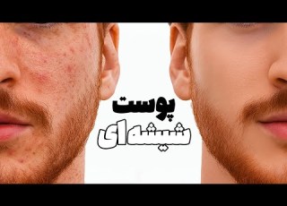 فقط ۶ دقیقه وقت بده تا پوستتو نجات بدم