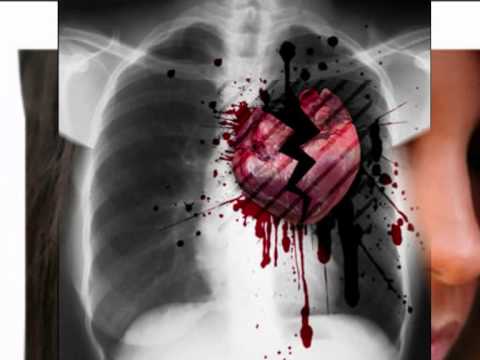 Cheb Tayeb Achkek Lia Madirih Mzia