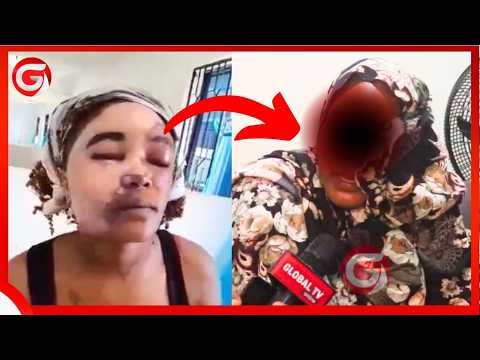 A MAN WHO FIGHTED UNTIL NIGHT AND WAS POURED FUEL ON HIS FIRE IN A BREAKING NEWS WILL SPEAK FROM