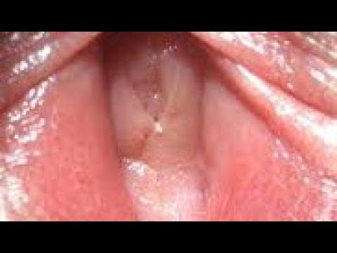 Kokunsan Abunda Kesa Gaban Mace Yabude Kokunsan Abunda Kesa Gaban Mace Yabude