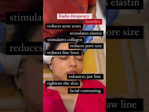 Radio Frequency Rf Is One Technology That Has Multiple Benefits By Dr Rashmi Shetty