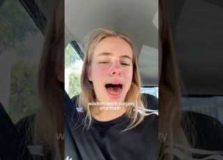 Stay Till The End For My Classiest Moment Nz Funny Viral Wisdomteeth Wisdomteethremoval