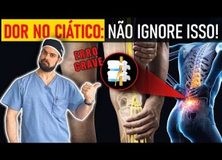 NERVO CIÁTICO O QUE É PORQUE INFLAMA E COMO TRATAR Ortopedista Explica