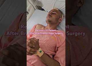 Recovery After Brain Hemorrhage Surgery Brainhemorrhage Neurosurgeon Shortsfeed Viralvideo