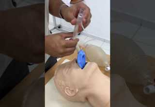 How To Insert A Laryngeal Airway Mask