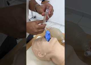 How To Insert A Laryngeal Airway Mask
