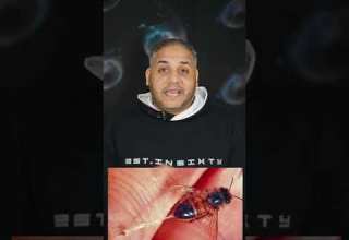 صورة للنحلة وهي بتقرص