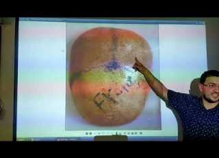 Practical General Anatomy 1 Bone 1 Dr Ahmed Hassan Elbatahgy